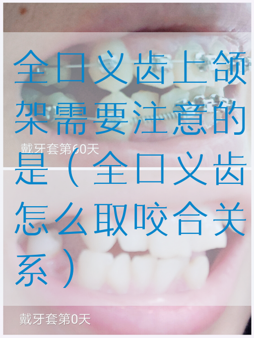 全口义齿上颌架需要注意的是（全口义齿怎么取咬合关系）