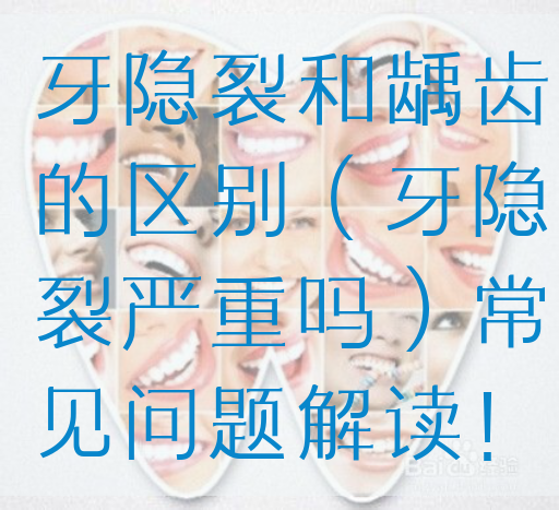 牙隐裂和龋齿的区别（牙隐裂严重吗）常见问题解读！