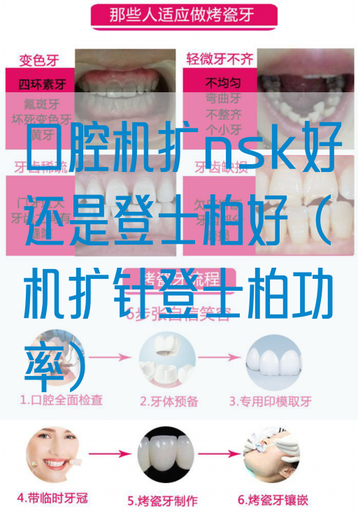 口腔机扩nsk好还是登士柏好（机扩针登士柏功率）