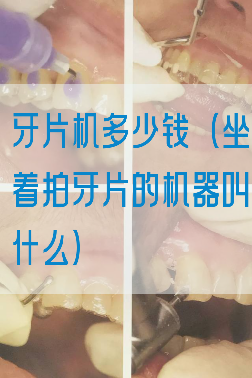 牙片机多少钱（坐着拍牙片的机器叫什么）