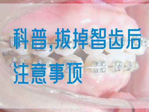 科普,拔掉智齿后注意事项