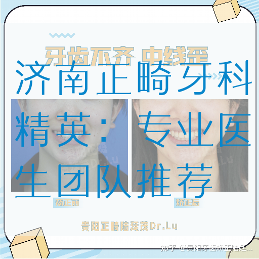 济南正畸牙科*英：专业医生团队推荐