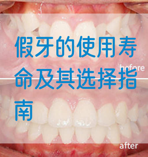 假牙的使用寿命及其选择指南