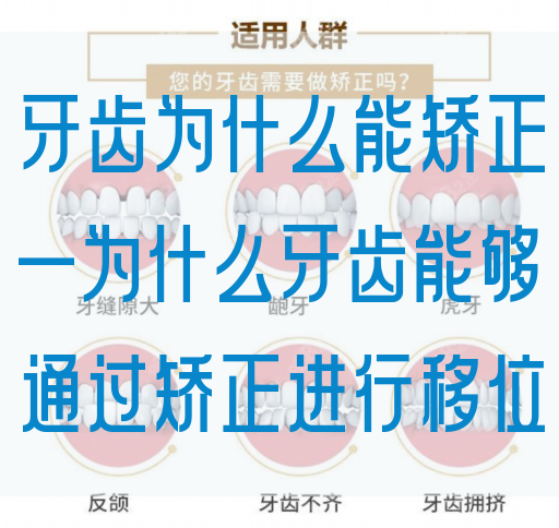 牙齿为什么能矫正—为什么牙齿能够通过矫正进行移位(图1)