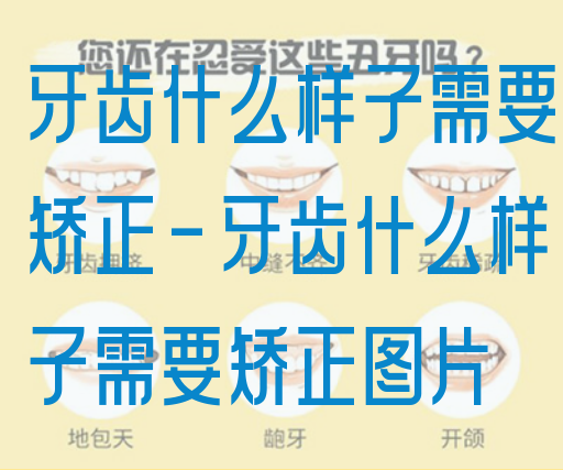 牙齿什么样子需要矫正-牙齿什么样子需要矫正图片(图1)