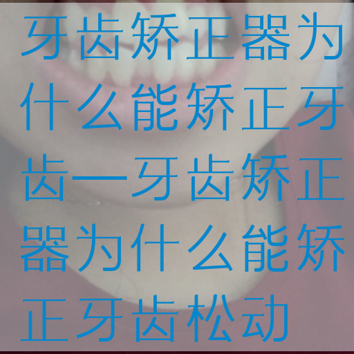 牙齿矫正器为什么能矫正牙齿—牙齿矫正器为什么能矫正牙齿松动(图1)