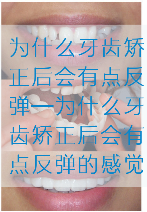 为什么牙齿矫正后会有点反弹—为什么牙齿矫正后会有点反弹的感觉(图1)