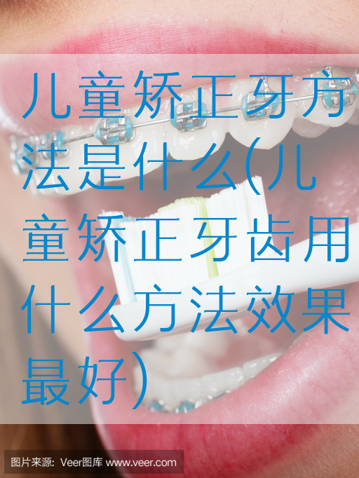 儿童矫正牙方法是什么(儿童矫正牙齿用什么方法效果最好)(图1)