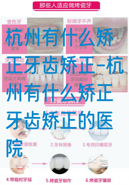 杭州有什么矫正牙齿矫正-杭州有什么矫正牙齿矫正的医院(图1)