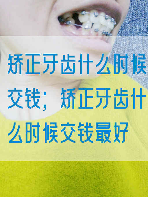 矫正牙齿什么时候交钱;矫正牙齿什么时候交钱最好(图1)