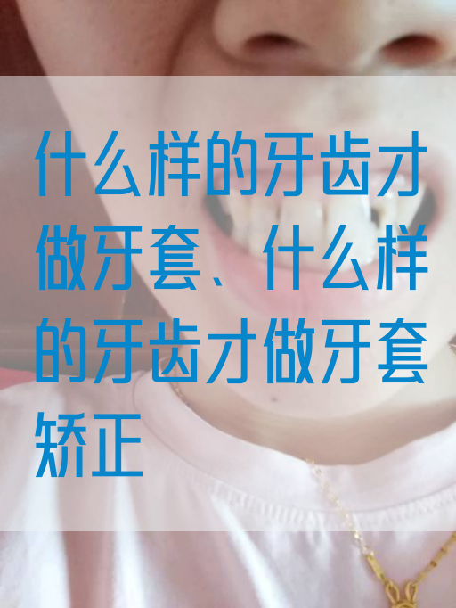 什么样的牙齿才做牙套、什么样的牙齿才做牙套矫正