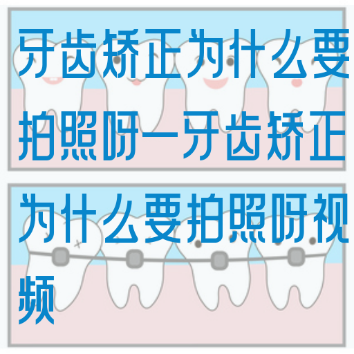 牙齿矫正为什么要拍照呀—牙齿矫正为什么要拍照呀视频