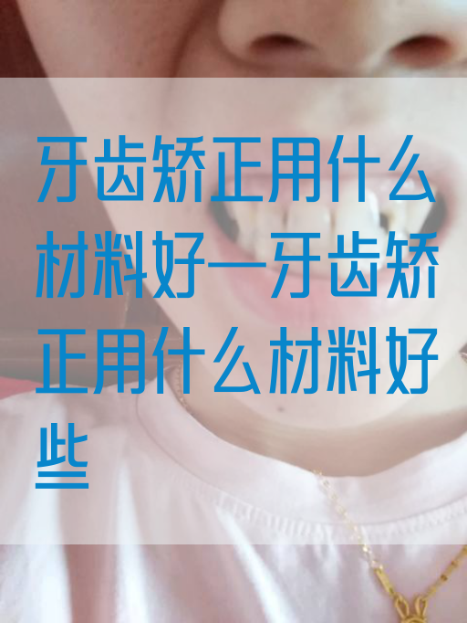 牙齿矫正用什么材料好—牙齿矫正用什么材料好些