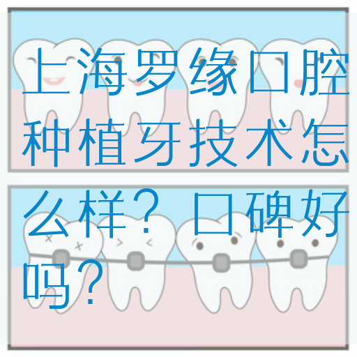 上海罗缘口腔种植牙技术怎么样？口碑好吗？
