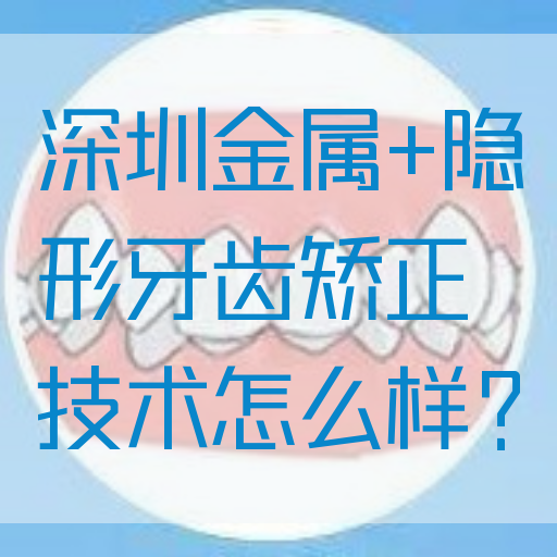 深圳金属+隐形牙齿矫正技术怎么样？