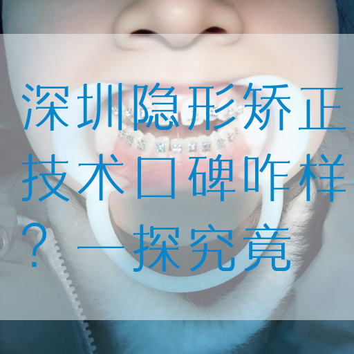 深圳隐形矫正技术口碑咋样？一探究竟