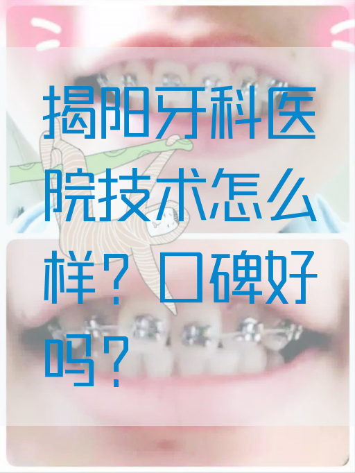 揭阳牙科医院技术怎么样？口碑好吗？
