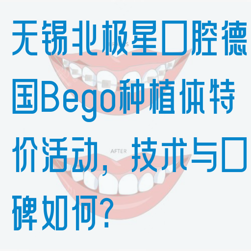 无锡北极星口腔德国Bego种植体特价活动，技术与口碑如何？