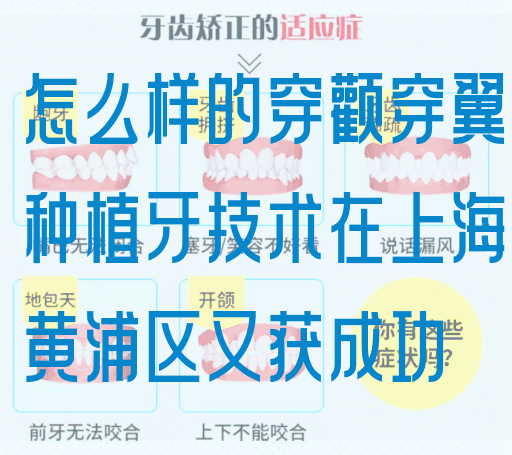 怎么样的穿颧穿翼种植牙技术在上海黄浦区又获成功