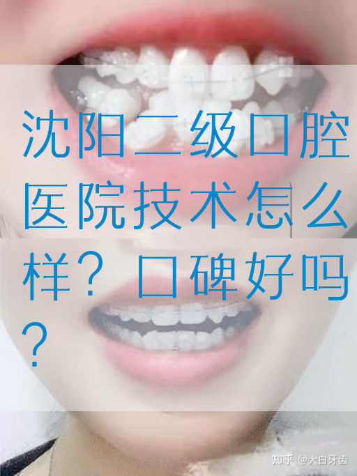 沈阳二级口腔医院技术怎么样？口碑好吗？