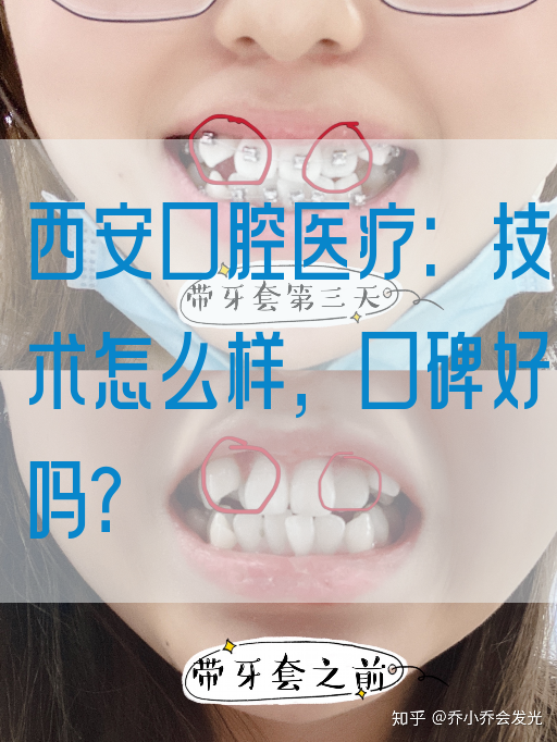 西安口腔医疗：技术怎么样，口碑好吗？