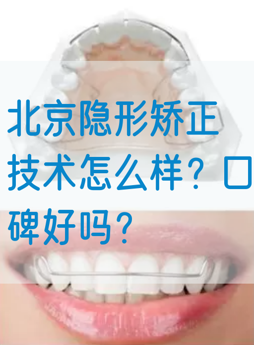 北京隐形矫正技术怎么样？口碑好吗？