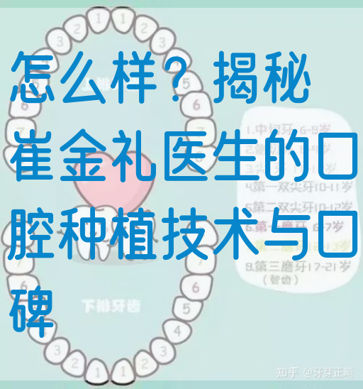 怎么样？揭秘崔金礼医生的口腔种植技术与口碑
