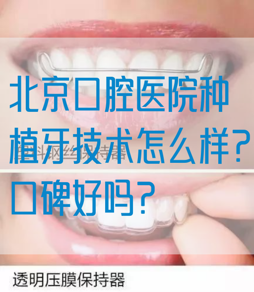 北京口腔医院种植牙技术怎么样？口碑好吗？