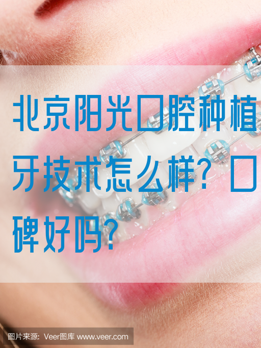 北京阳光口腔种植牙技术怎么样？口碑好吗？