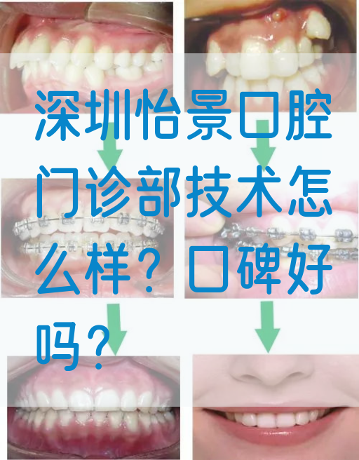 深圳怡景口腔门诊部技术怎么样？口碑好吗？