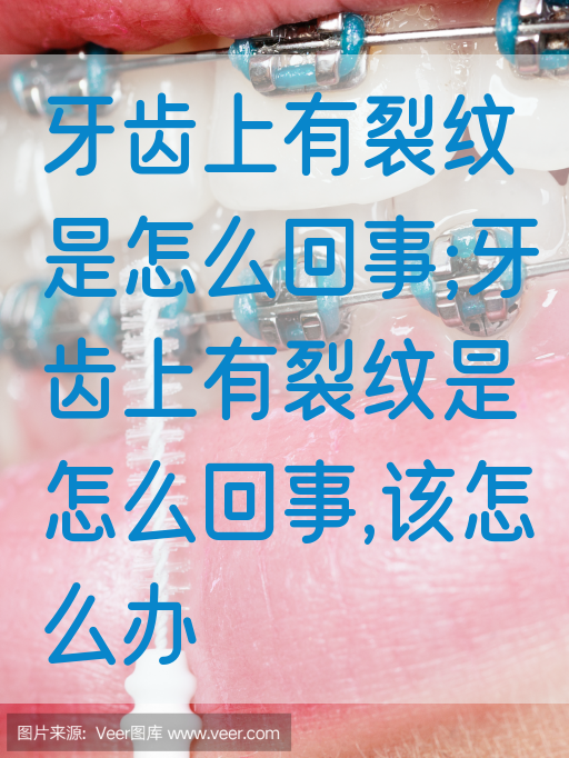 牙齿上有裂纹是怎么回事;牙齿上有裂纹是怎么回事,该怎么办