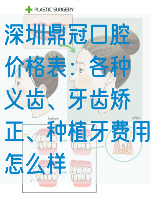 深圳鼎冠口腔价格表：各种义齿、牙齿矫正、种植牙费用怎么样
