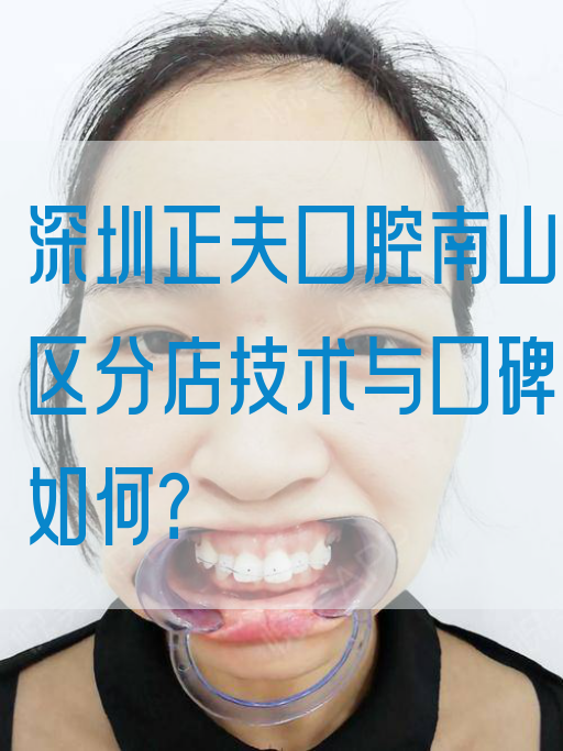 深圳正夫口腔南山区分店技术与口碑如何？