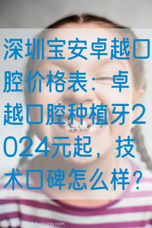 深圳宝安卓越口腔价格表：卓越口腔种植牙2024元起，技术口碑怎么样？