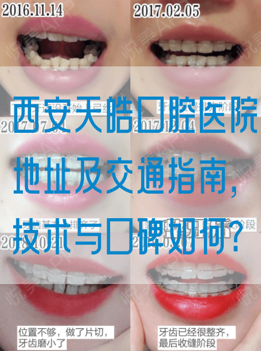 西安天皓口腔医院地址及交通指南，技术与口碑如何？