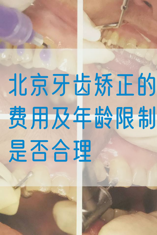 北京牙齿矫正的费用及年龄限制是否合理