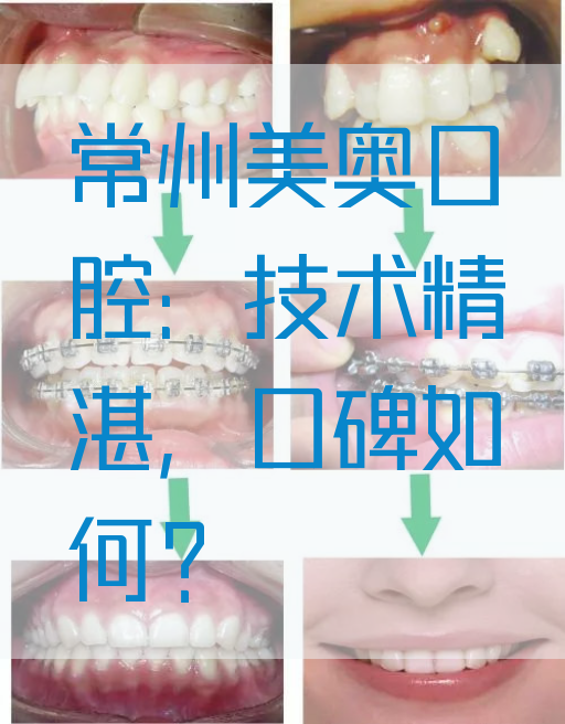 常州美奥口腔：技术*湛，口碑如何？