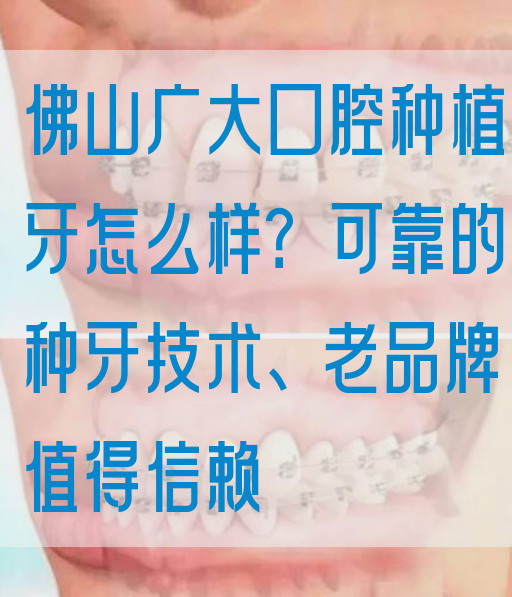 佛山广大口腔种植牙怎么样？可靠的种牙技术、老品牌值得信赖