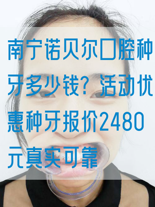 南宁诺贝尔口腔种牙多少钱？活动优惠种牙报价2480元真实可靠
