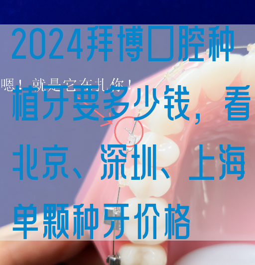 2024拜博口腔种植牙要多少钱，看北京、深圳、上海单颗种牙价格