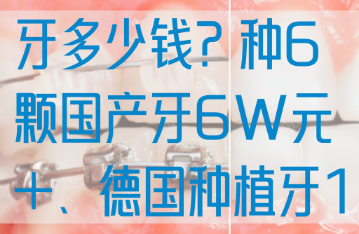 一次性种植6颗牙多少钱？种6颗国产牙6W元+、德国种植牙10W元起