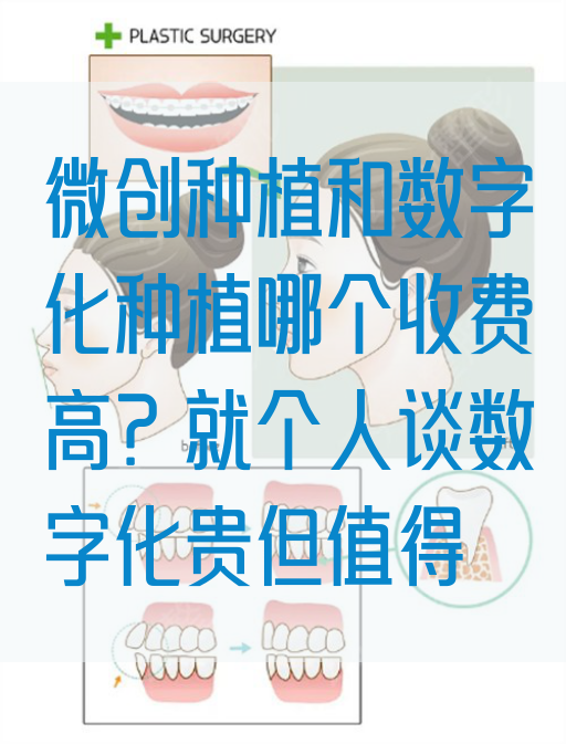 微创种植和数字化种植哪个收费高？就个人谈数字化贵但值得