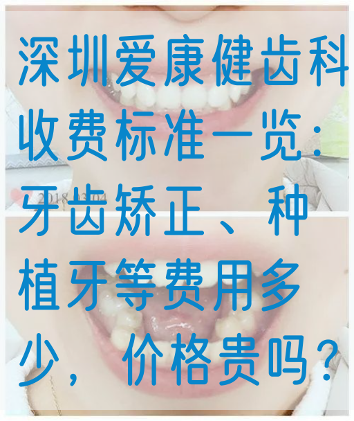 深圳爱康健齿科收费标准一览：牙齿矫正、种植牙等费用多少，价格贵吗？