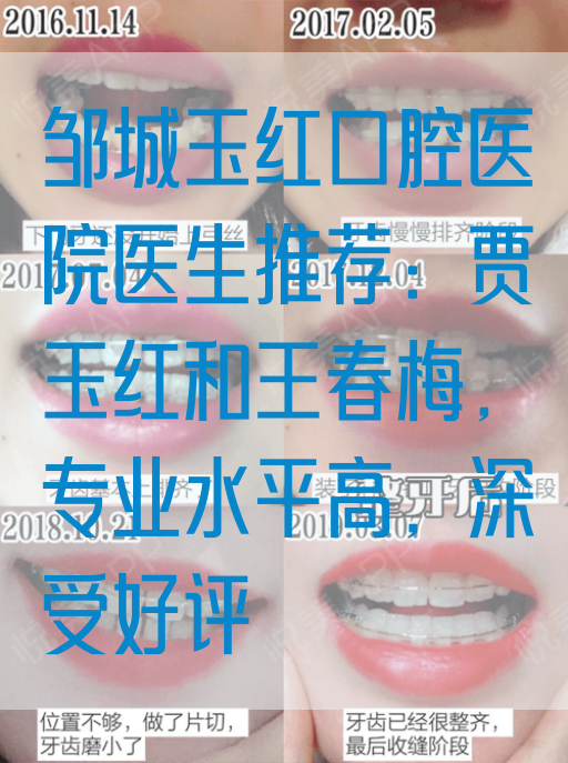 邹城玉红口腔医院医生推荐：贾玉红和王春梅，专业水平高，深受好评