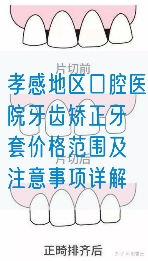 孝感地区口腔医院牙齿矫正牙套价格范围及注意事项详解