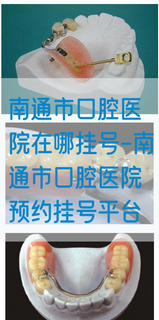 南通市口腔医院在哪挂号-南通市口腔医院预约挂号平台