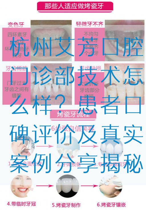 杭州艾芳口腔门诊部技术怎么样？患者口碑评价及真实案例分享揭秘