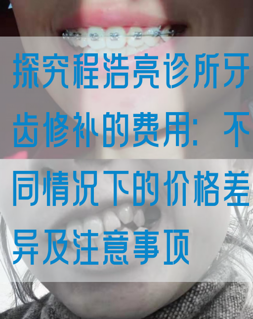探究程浩亮诊所牙齿修补的费用：不同情况下的价格差异及注意事项