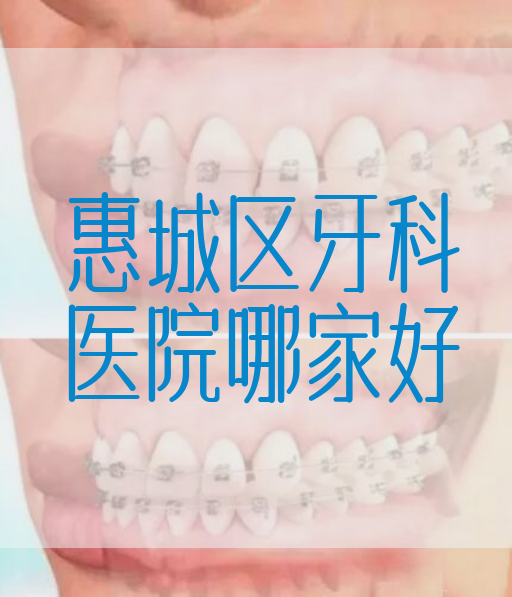 惠城区牙科医院哪家好