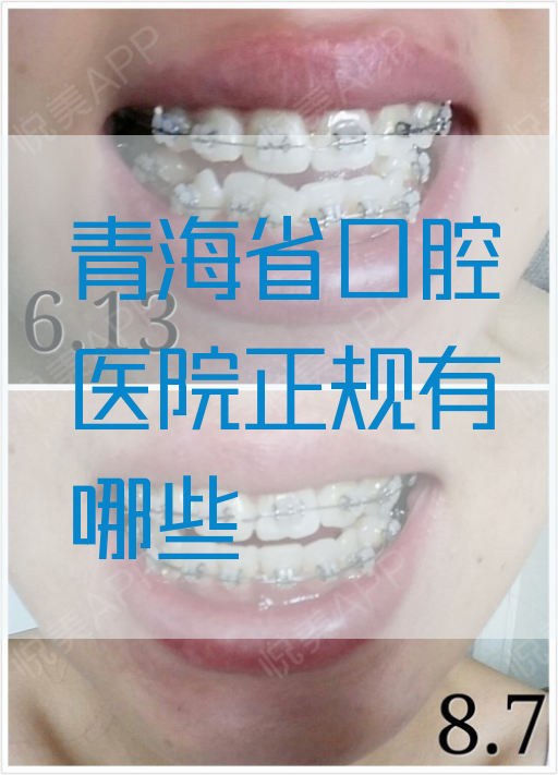 青海省口腔医院正规有哪些